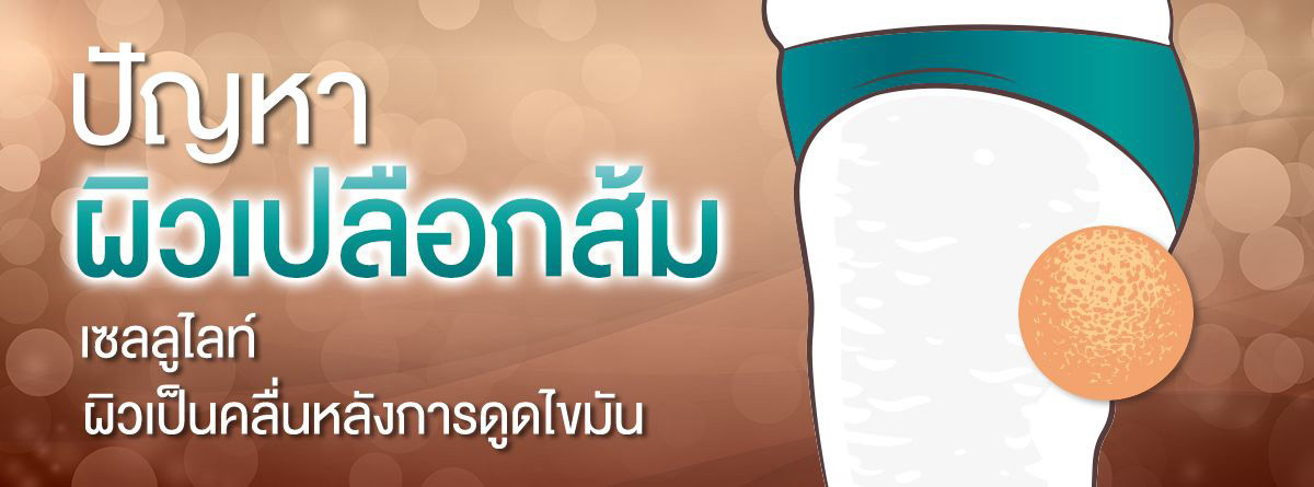 slimlaserthailand